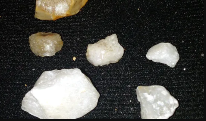  أحجار الماس
